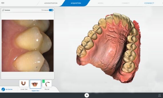 Full arch scan with CEREC Primescan